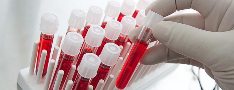 Llun llaw gwyddonydd gyda ffiolau gwaed.